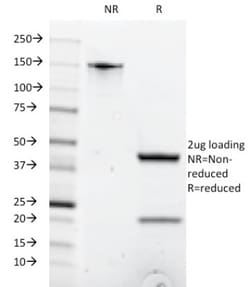 Mouse anti-Cd8a, Clone: C8/1035, Novus Biologicals 0.2mg; Unlabeled:Antibodies,